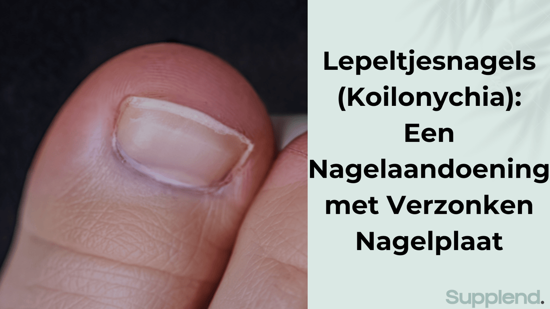Lepeltjesnagels (Koilonychia): Een Nagelaandoening met Verzonken Nagelplaat