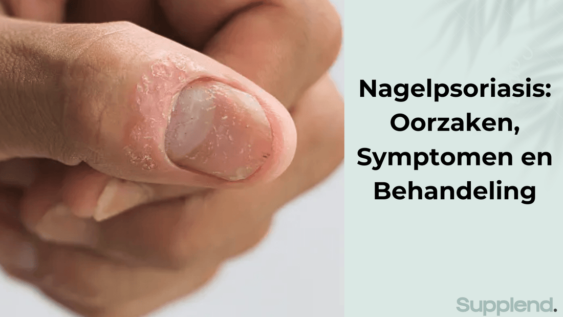 Nagelpsoriasis: Oorzaken, Symptomen en Behandeling