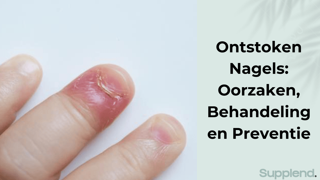 Ontstoken Nagels: Oorzaken, Behandeling en Preventie