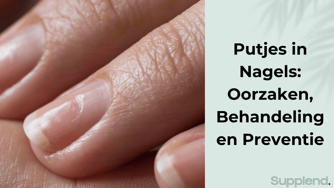 Putjes in Nagels: Oorzaken, Behandeling en Preventie