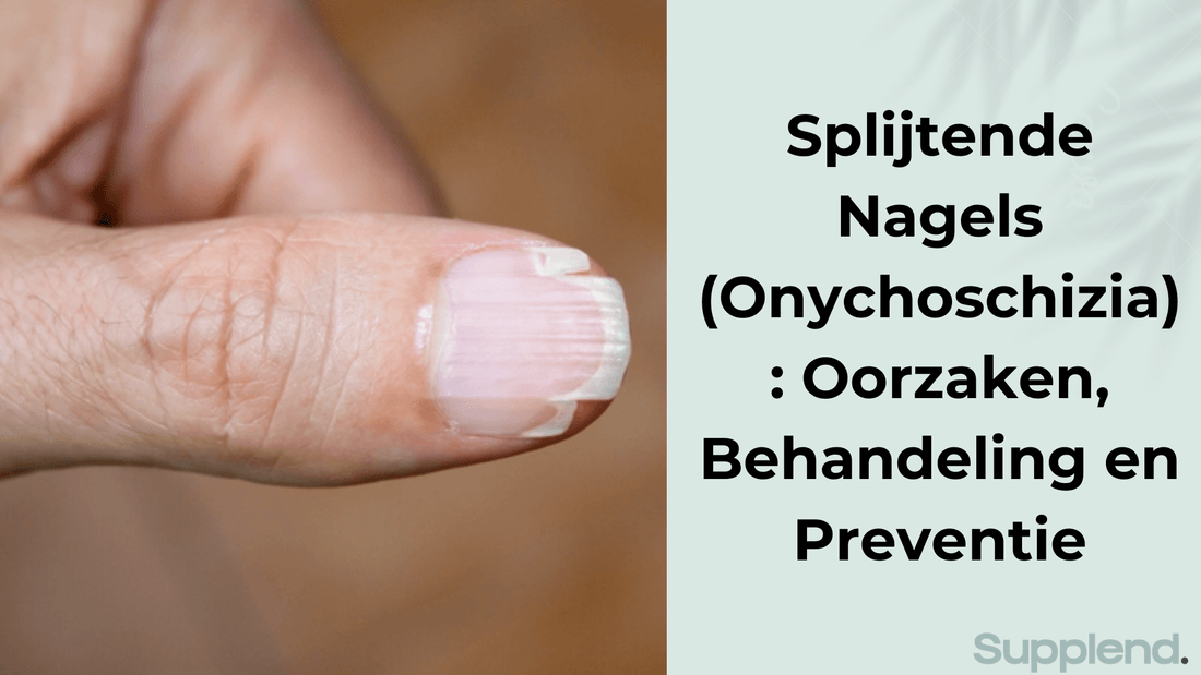 Splijtende Nagels (Onychoschizia): Oorzaken, Behandeling en Preventie