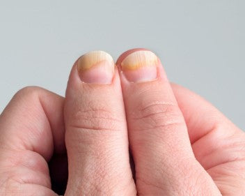 gele nagels door nagellak