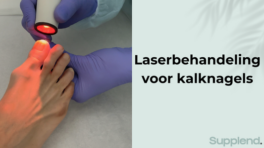 Laserbehandeling voor kalknagels