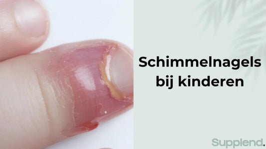 Schimmelnagels bij kinderen